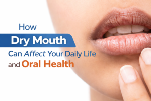 How Dry Mouth Can Affect Your Daily Life and Oral Health
